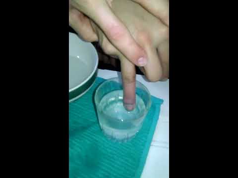 how to drain pus from a hangnail