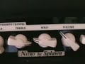 Splawn Nitro Brootalz