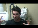 Laser Acne Scar Removal Testimonial Laser Acne Scar Removal Testimonial