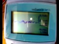 Home Made ECG with oscilloscope