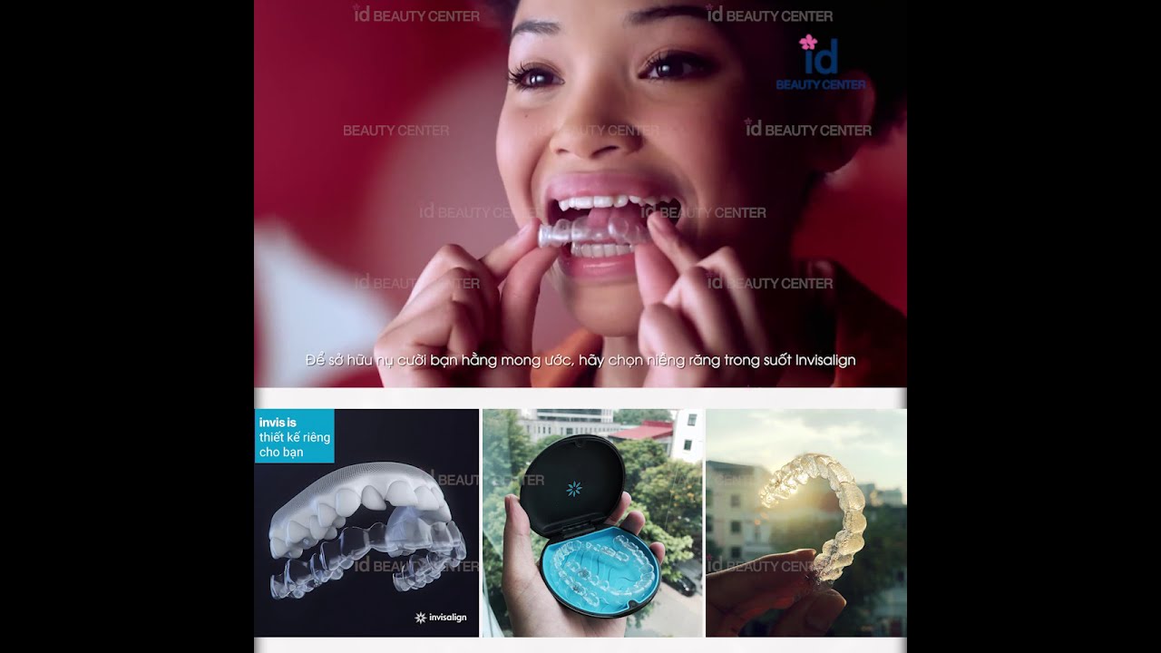 Niềng Răng trong suốt Invisalign