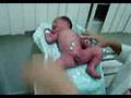 Bebê Cauê em seu primeiro banho
