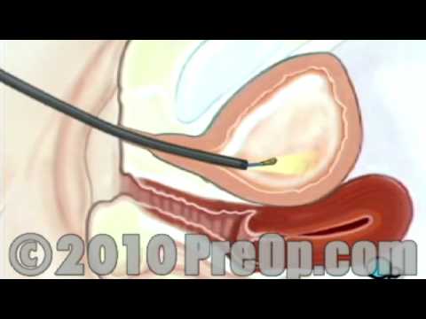 vaginal