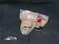 This is a video of my Mom and I (Mandy Kemp)on the Montel Williams Show talking about my never been done before jaw surgery.