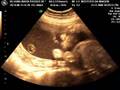 videos de Julia Vasconcelos na barriga da mamae