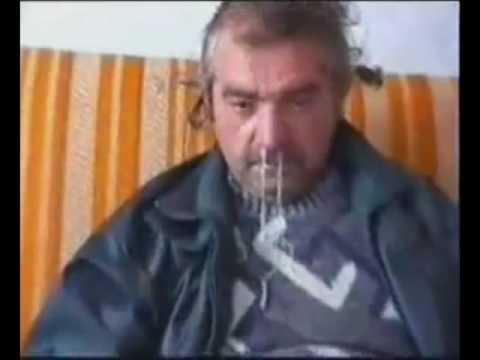 Taknyos csávó visszafelé