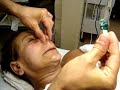 Terry Binns Cirepil Blue Nose Waxing Terry Binns Cirepil Blue Nose Waxing