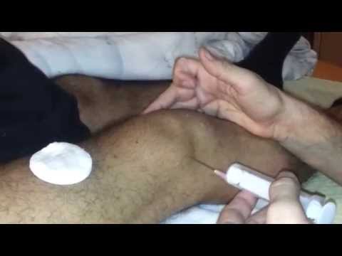 how to drain knee fluid at home