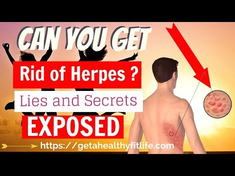how to get rid of hhv 6