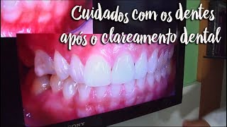 Fica a Dica - Cuidados com os dentes após o clareamento dental