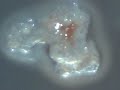 Morgellons Nano UFO  (unidentified floating object)