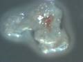 Morgellons Nano UFO (unidentified floating object)