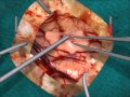 Microneurosurgery Training - NeuroTouch Simulator - Part 2 Microneurosurgery Training - NeuroTouch Simulator - Part 2