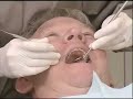 Delta Dental of Tennessee Periodontitis Ad Delta Dental of Tennessee Periodontitis Ad