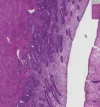 endometrium - Shotgun Histology Proliferative Endometrium.