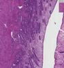 Shotgun Histology Proliferative Endometrium
