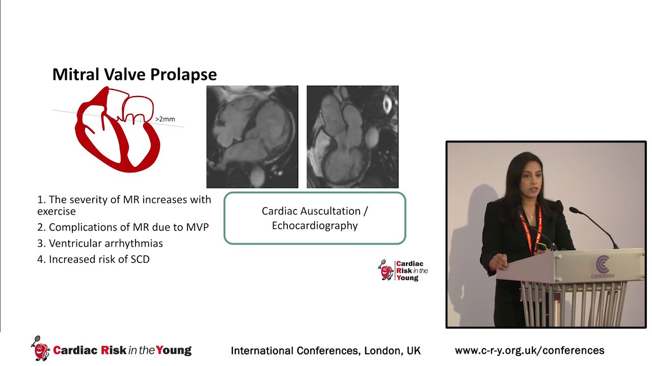 Exercising with Aortic and Mitral Valve Disease - Dr Sabiha Gati