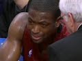 Dwyane Wade Shoulder Injury Dwyane Wade Shoulder Injury