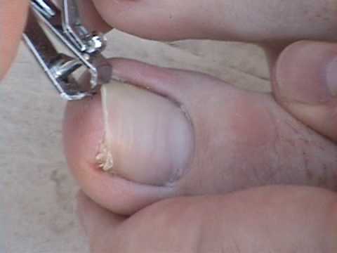 how to properly trim toenails