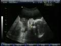 videos de Title 01 01