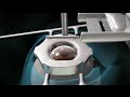 Cirug-a-ocular-LASIK