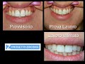 Progetto Zirconia - Presentazione Laboratorio