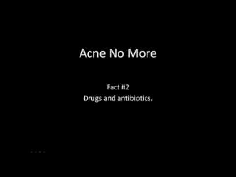 how to make back acne go away