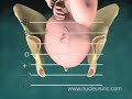 3D Medical Animation:  Childbirth Stations of Presentation