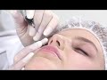 Semi-permanent eyeliner with Debra Robson-Lawrence Semi-permanent eyeliner with Debra Robson-Lawrence
