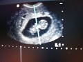 november 8, 2007 was the first time we saw our baby. we heard, and saw it's heart beating.  and it looked like it was waving at us with its little arm buds.