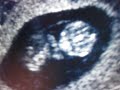 november 8, 2007 was the first time we saw our baby. we heard, and saw it's heart beating.  and it looked like it was waving at us with its little arm buds.