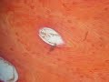 Hueso descalicificado Microscop�a de Polarizaci�n