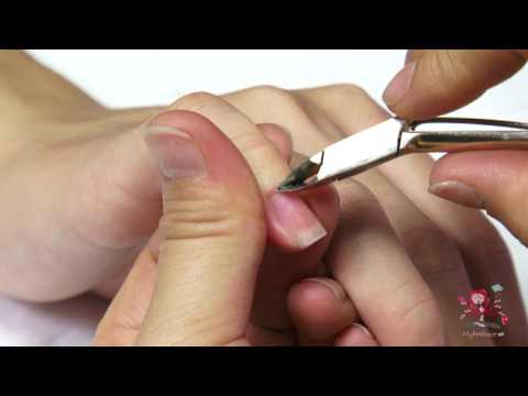 how to get rid cuticles