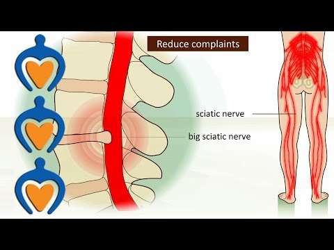 how to recover back pain