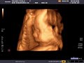 Amanda and Eugene's baby