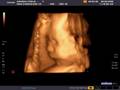 Amanda and Eugene's baby