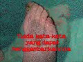 VCO Kencing Manis ( Diabetes )