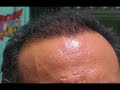 Dr Bisanga - BHR Clinic Dr Bisanga - BHR Clinic