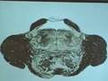 Pons (Level of Motor and principle sensory nuclei of CN V)
