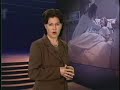 mechanical ventilation - APRV 2