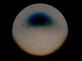 My sperm under my microscope Semen Analysis