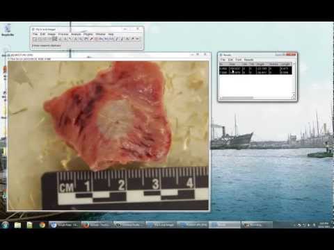 how to use imagej to measure length