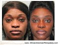 Educational Video Describing Rhinoplasty in African Americans, Hispanic and Ethnic Patients