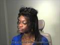 African American Rhinoplasty- AfricanAmericanRhinoplasty.com
