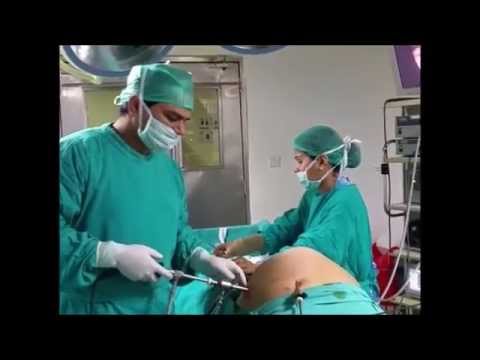 how to treat umbilical hernia