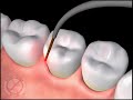 a dental animation