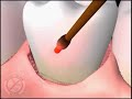 a dental animation