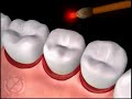 a dental animation