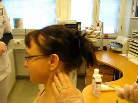 Trigger point injection treatment for tinnitus by Marja Estola (parts 1-3)