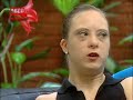 Down syndrome:&nbsp;Sindrome di Down: Bailarina Aline Favaro